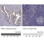 Anti-ANO1 Antibody
