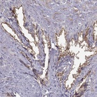 Immunohistochemical staining of human seminal vesicle shows high expression.