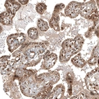 Immunohistochemical staining of human placenta shows moderate nuclear positivity in trophoblastic cells.
