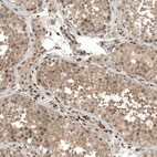 Anti-FOXR2 Antibody