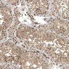 Immunohistochemical staining of human testis shows strong nuclear positivity in Leydig cells.