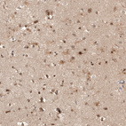 Immunohistochemical staining of human cerebral cortex shows moderate nuclear positivity in neurons.