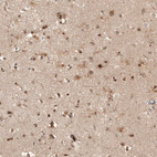 Anti-FOXR2 Antibody