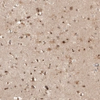 Immunohistochemical staining of human cerebral cortex shows moderate nuclear positivity in neurons.