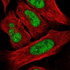 Immunofluorescent staining of human cell line U-2 OS shows localization to nucleoplasm.
