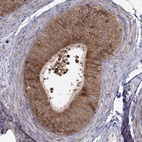 Anti-LONRF2 Antibody