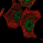 Anti-LONRF2 Antibody