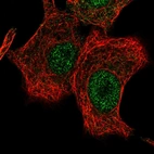 Immunofluorescent staining of human cell line A549 shows localization to nucleus.
