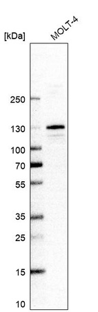 Anti-RBM10 Antibody