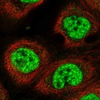 Immunofluorescent staining of human cell line A-431 shows localization to nuclear speckles.