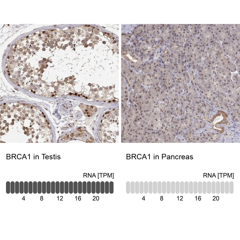 Anti-BRCA1 Antibody