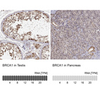 Anti-BRCA1 Antibody