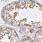 Immunohistochemical staining of human testis shows high expression.