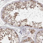 Immunohistochemical staining of human testis shows high expression.
