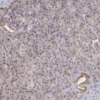 Anti-BRCA1 Antibody