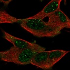 Anti-GPR155 Antibody