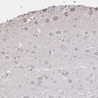 Anti-C20orf24 Antibody