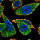 Immunofluorescent staining of human cell line PC-3 shows localization to cytosol.