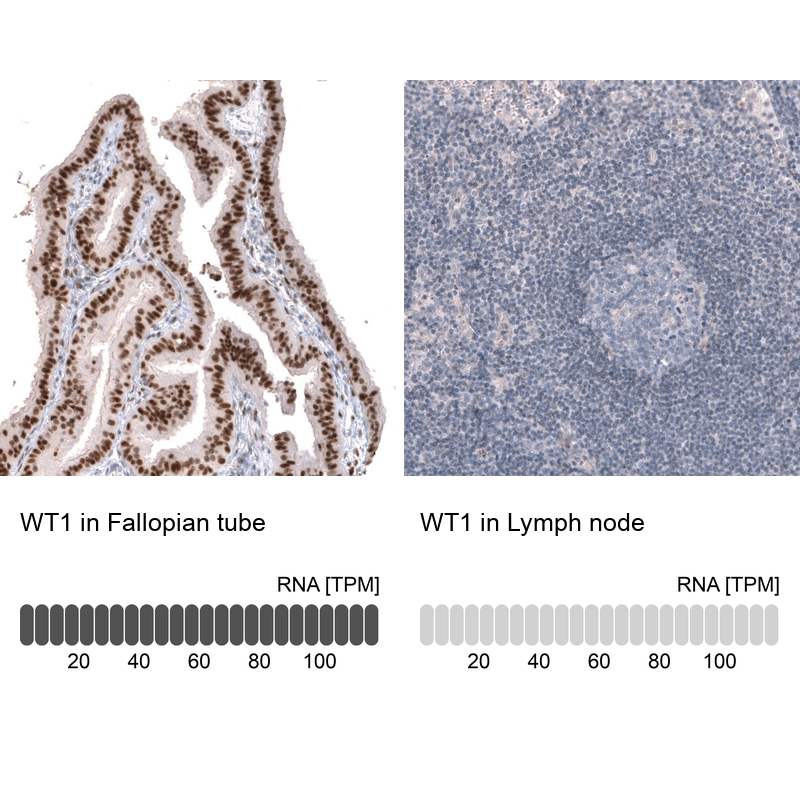 Anti-WT1 Antibody