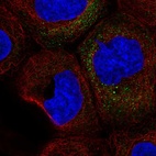 Anti-CSF2 Antibody