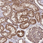 Anti-NMNAT3 Antibody