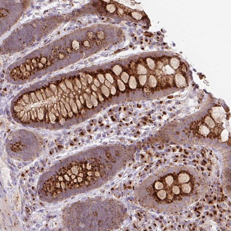 Anti-RP11-111M22.2 Antibody