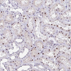 Anti-WDR72 Antibody