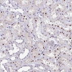 Immunohistochemical staining of human kidney shows moderate to strong nuclear positivity in cells in tubules.