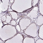 Immunohistochemical staining of human thyroid gland shows moderate to strong nuclear positivity in follicular cells.