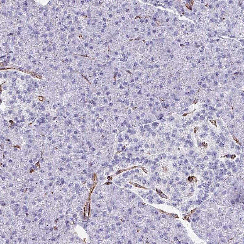 Anti-SLC35B1 Antibody