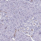 Anti-SLC35B1 Antibody