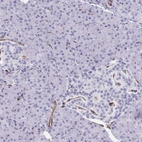 Anti-SLC35B1 Antibody