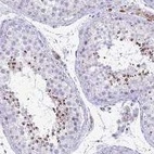 Anti-TSBP1 Antibody