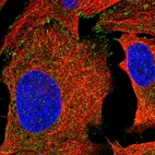Immunofluorescent staining of human cell line U-2 OS shows localization to cytosol & focal adhesion sites.