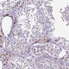 Anti-HOXB4 Antibody