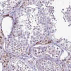 Immunohistochemical staining of human testis shows moderate cytoplasmic positivity in Leydig cells.