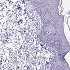 Immunohistochemical staining of human skin shows no positivity in squamous epithelial cells.