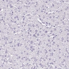 Immunohistochemical staining of human liver shows no positivity in hepatocytes.