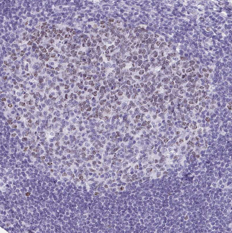 Anti-SUZ12 Antibody