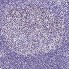 Anti-SUZ12 Antibody