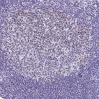 Anti-SUZ12 Antibody