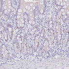 Anti-SUZ12 Antibody