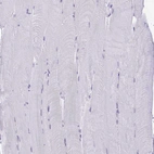 Immunohistochemical staining of human skeletal muscle shows no positivity in myocytes as expected.