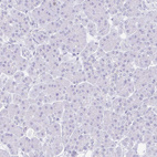 Immunohistochemical staining of human pancreas shows no positivity in exocrine glandular cells as expected.