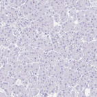 Anti-SUZ12 Antibody