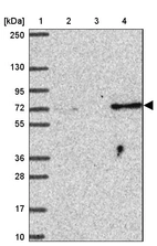Lane 1: Marker [kDa] 250, 130, 95, 72, 55, 36, 28, 17, 10_br/_Lane 2: Human cell line RT-4_br/_Lane 3: Human cell line U-251MG sp_br/_Lane 4: Human plasma (IgG/HSA depleted)