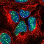 Anti-SUZ12 Antibody