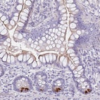 Anti-FBXO47 Antibody