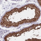 Anti-ADAMTSL1 Antibody