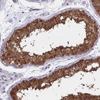 Anti-ADAMTSL1 Antibody